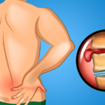 back_pain_image